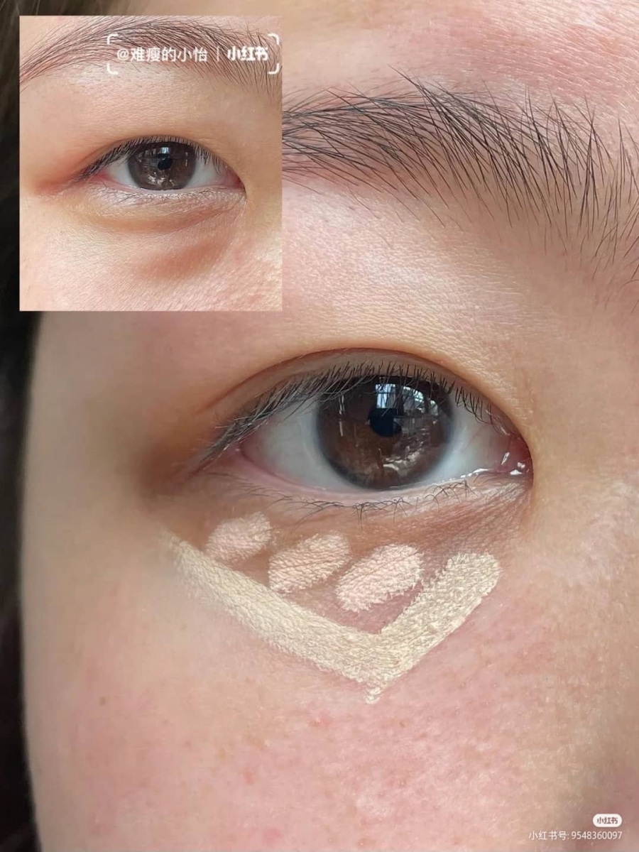 「重度黑眼圈遮瑕法」