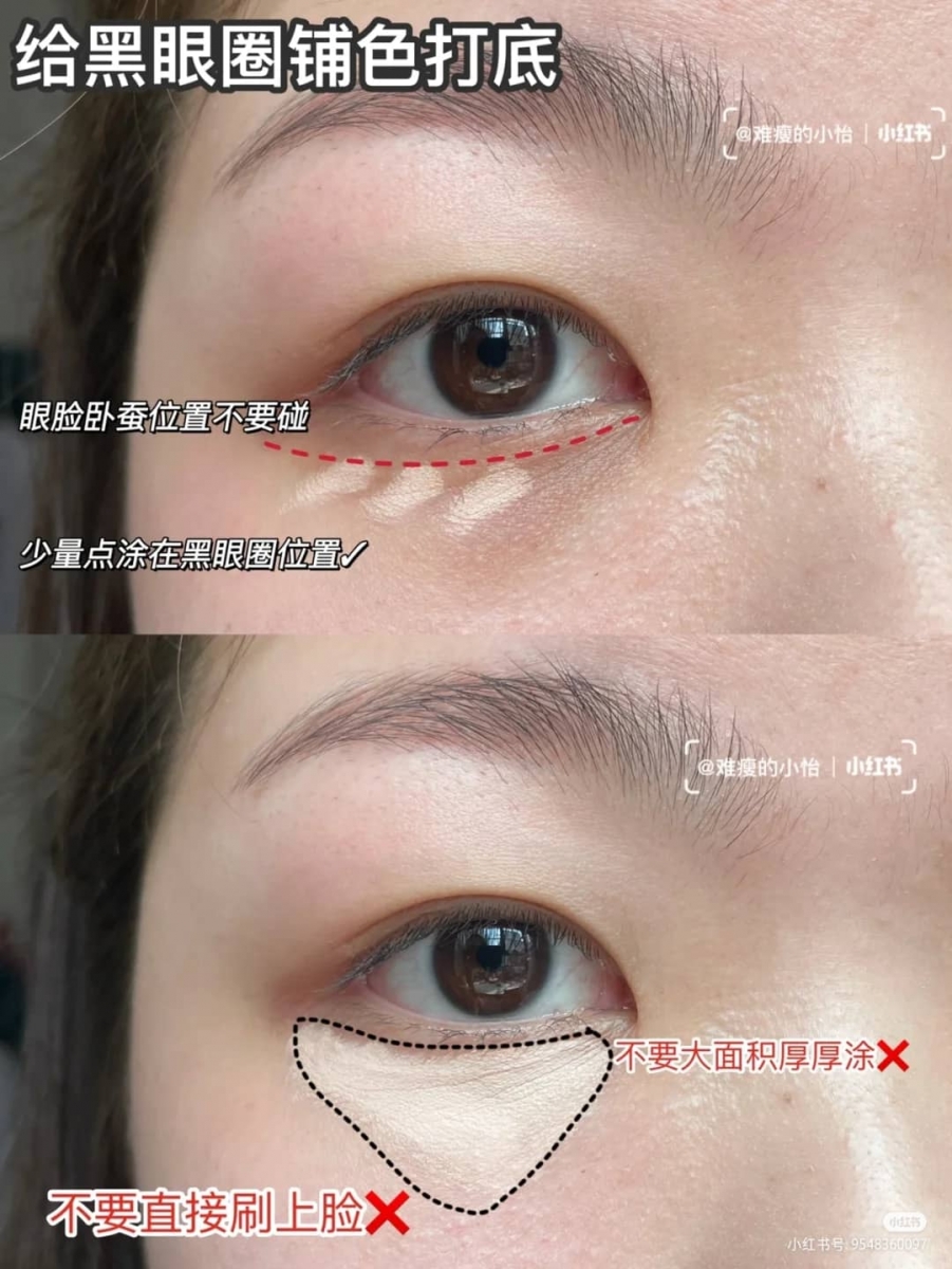 「重度黑眼圈遮瑕法」