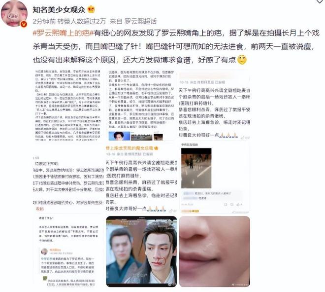 网发现他的脸有疤痕