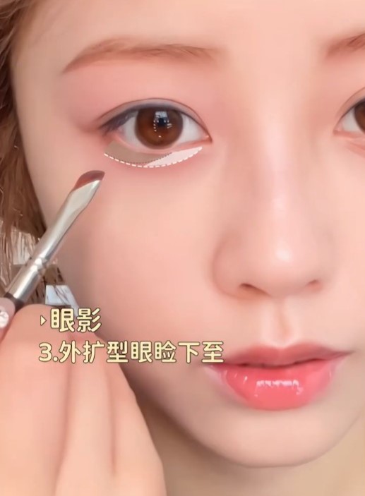 「外扩型眼睑下至」