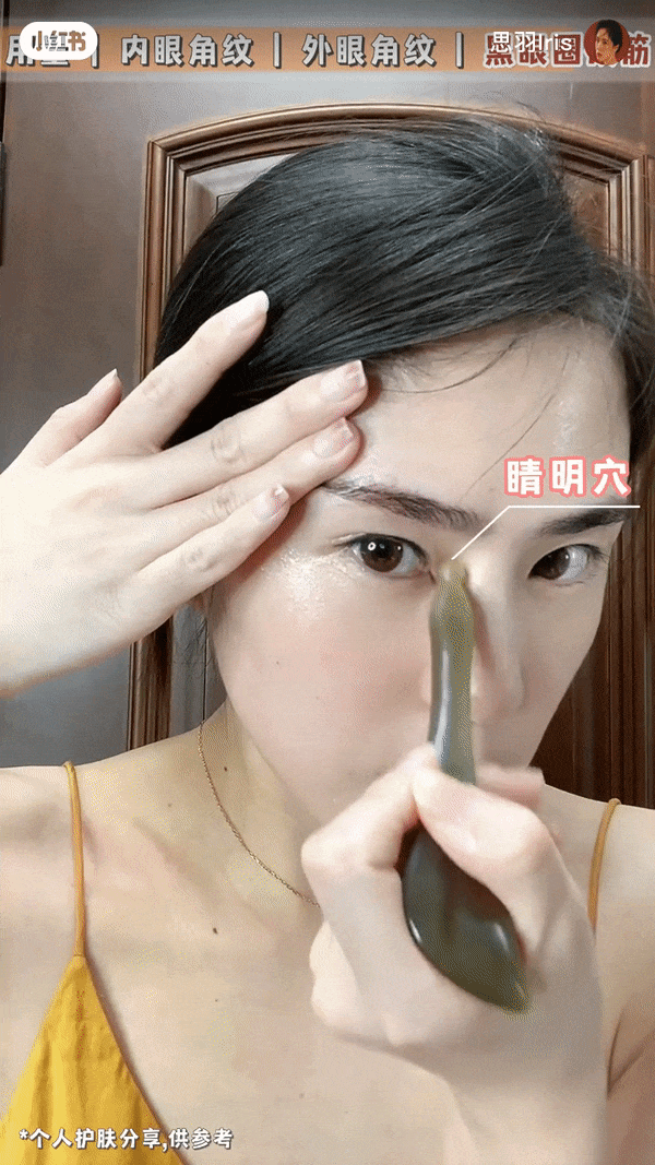 从“睛明穴”出发,带到“承泣”、“四白”、“球后”