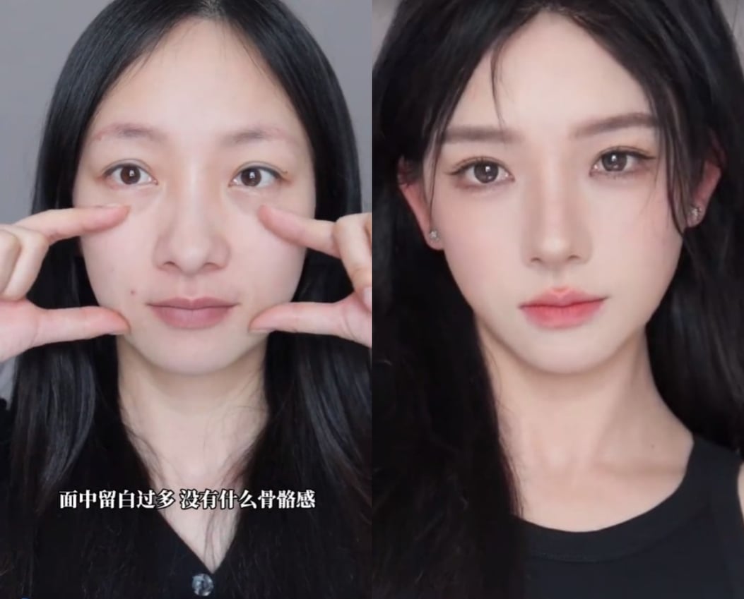 👑高级幼态脸打造🤩 经过专业的美学设计面部变的饱满而柔美的面部轮廓有没有更漂亮些更精致#轻医美非传统医美#, image size:1053x849