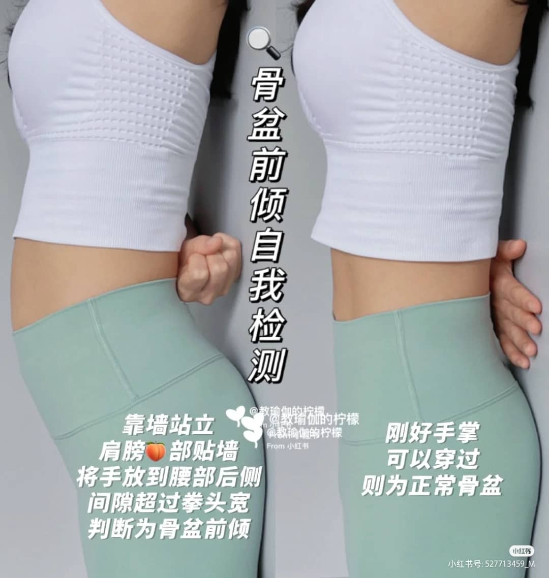 自我检测有没有「骨盆前倾」的问题