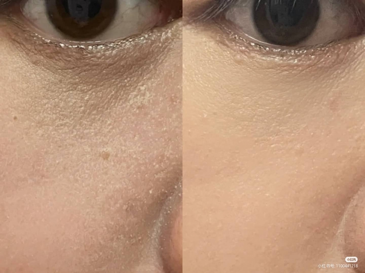 Goss大叔的MSBB底妆法