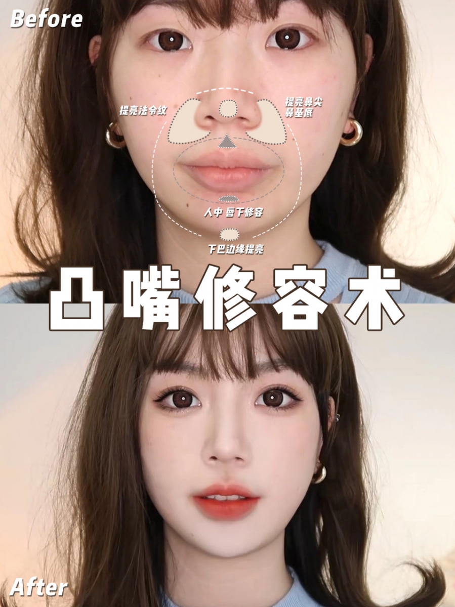 用化妆手法改善嘴凸问题