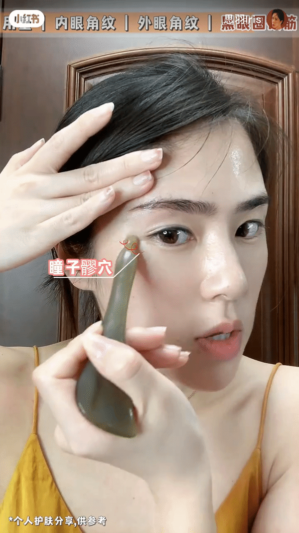 “瞳子髎穴”→“太阳穴”
