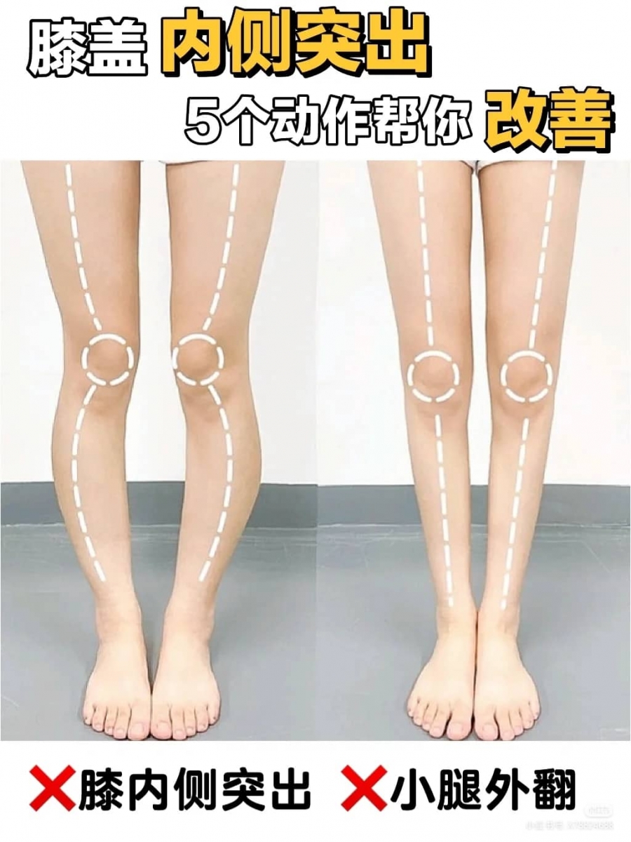 5个改善腿型动作