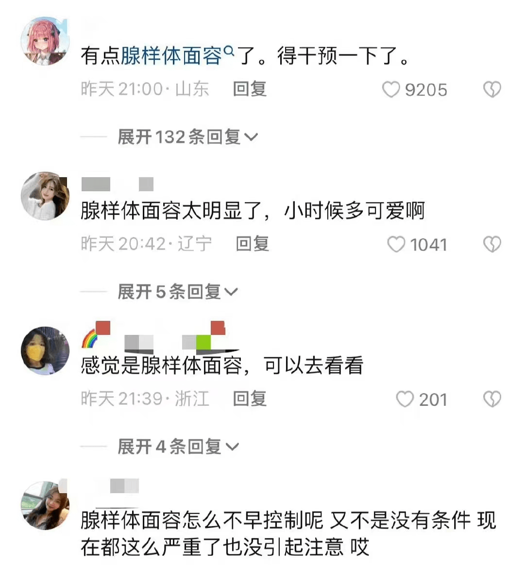 却被网友疯狂吐槽疑似出现了腺样体面容