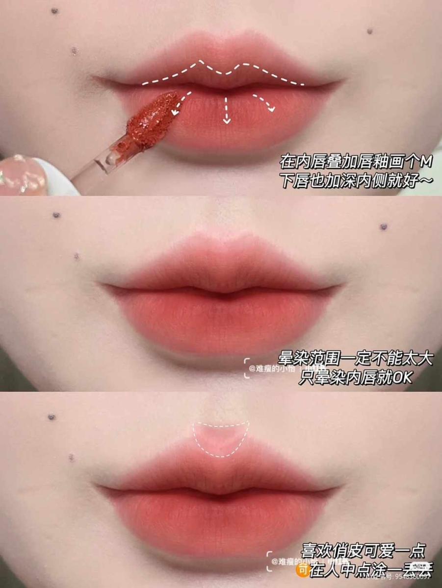 1、凸嘴厚唇变「微笑唇」