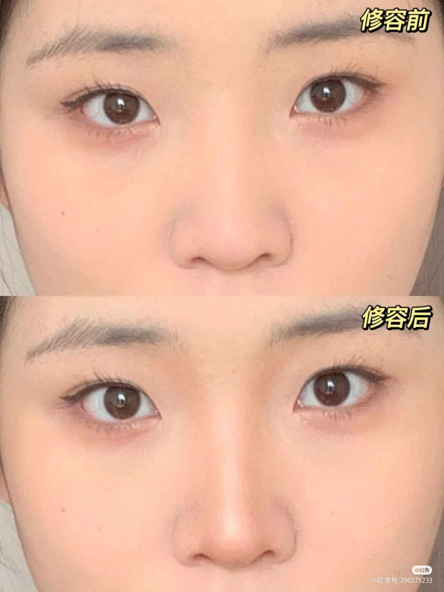 步骤1、鼻子修容