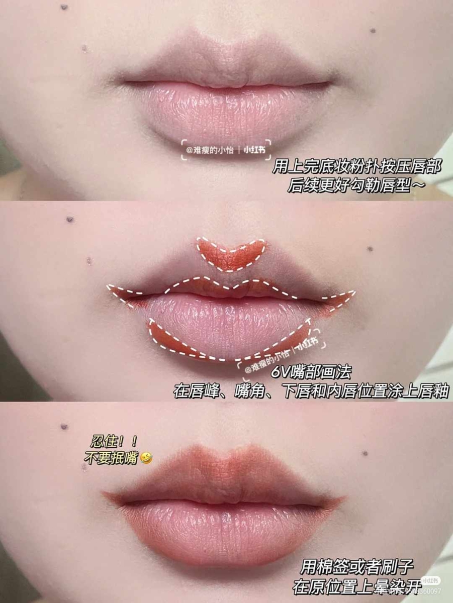 1、凸嘴厚唇变「微笑唇」