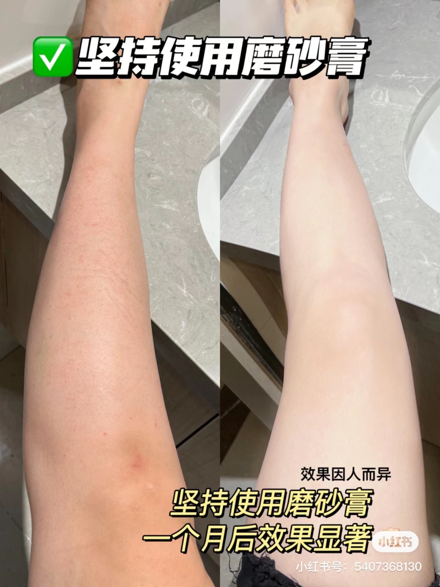 坚持使用磨砂膏去死皮和角质