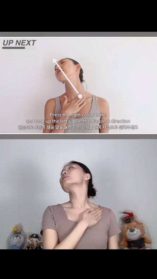 Step 1/ 拉伸颈阔肌