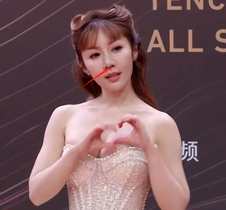 3、红毯摔倒还流鼻血