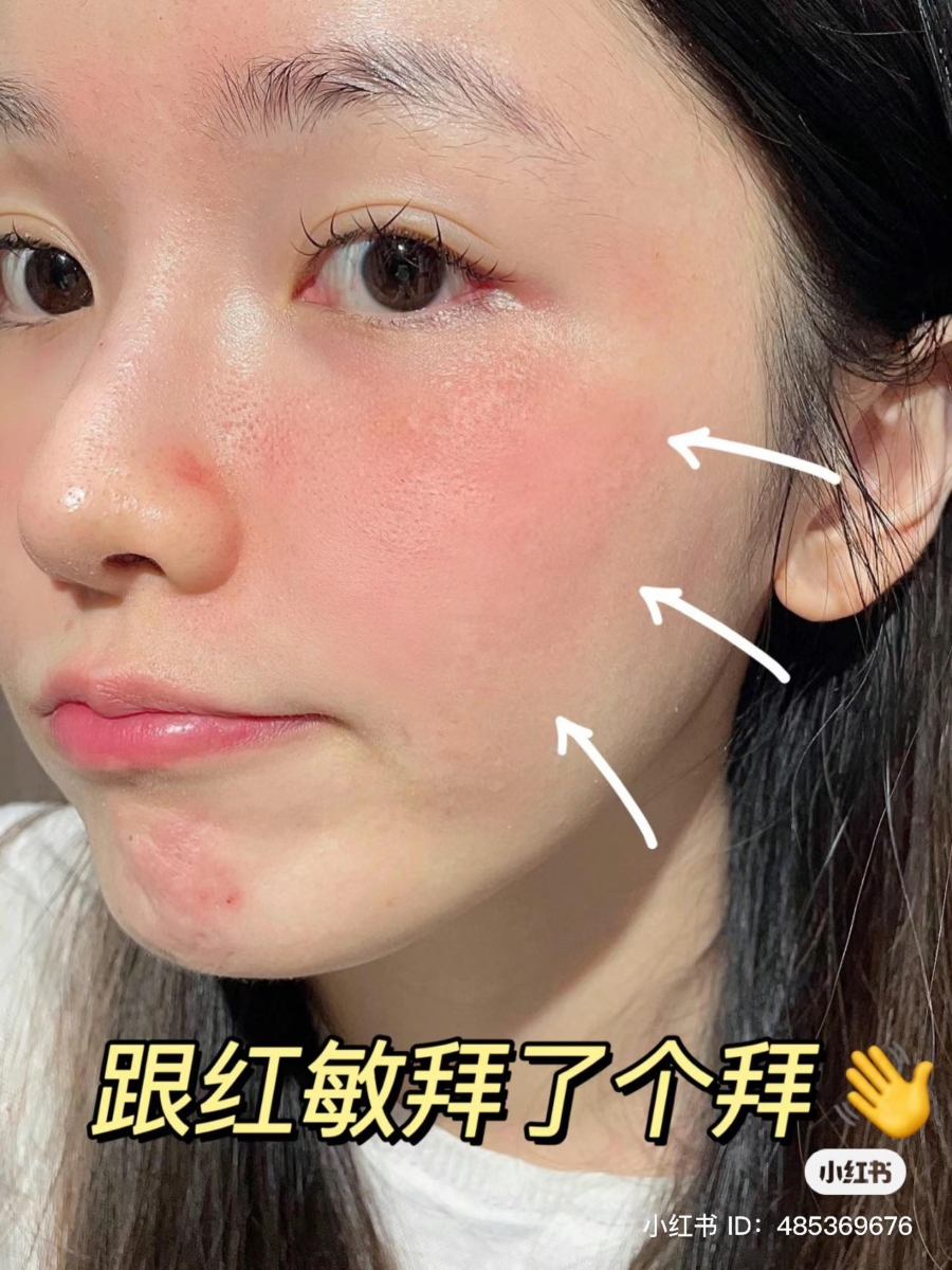 敏感肌救星