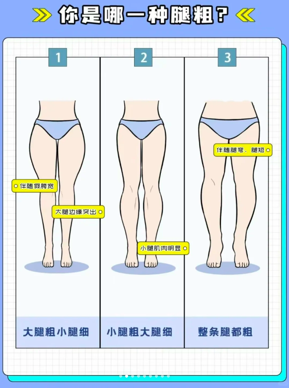 1、找出自己是哪种腿型