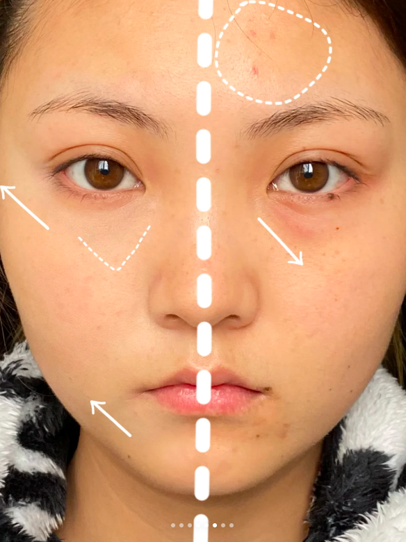 2步骤遮住「黑眼圈+泪沟」