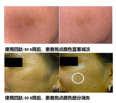 使用后就可以让妈妈们减少衰老迹象,肌肤也变得更加紧致白嫩❤️~