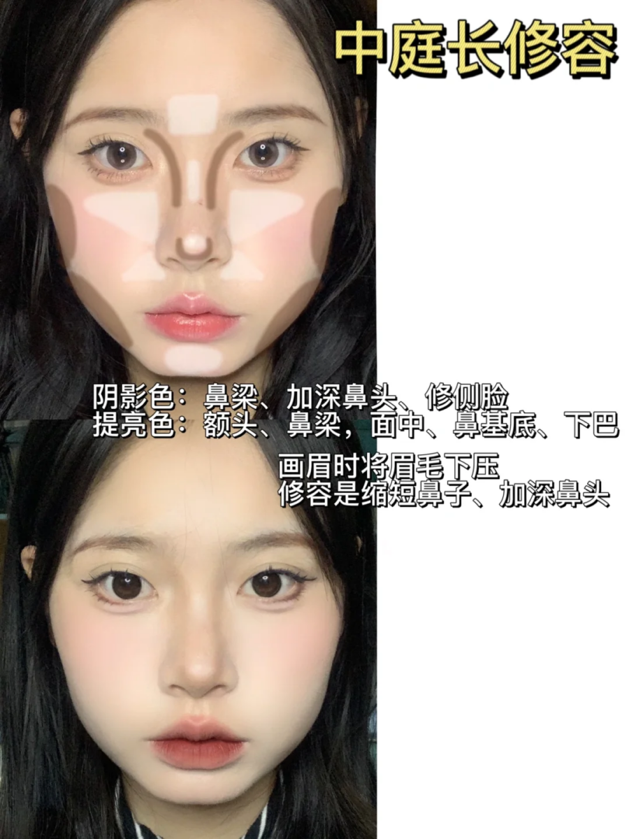 5）缩短中庭修容法