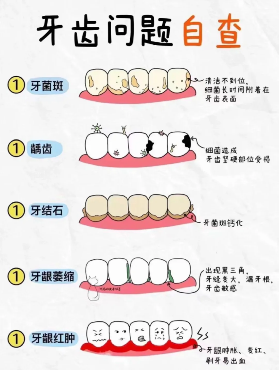 4)各种牙齿疾病