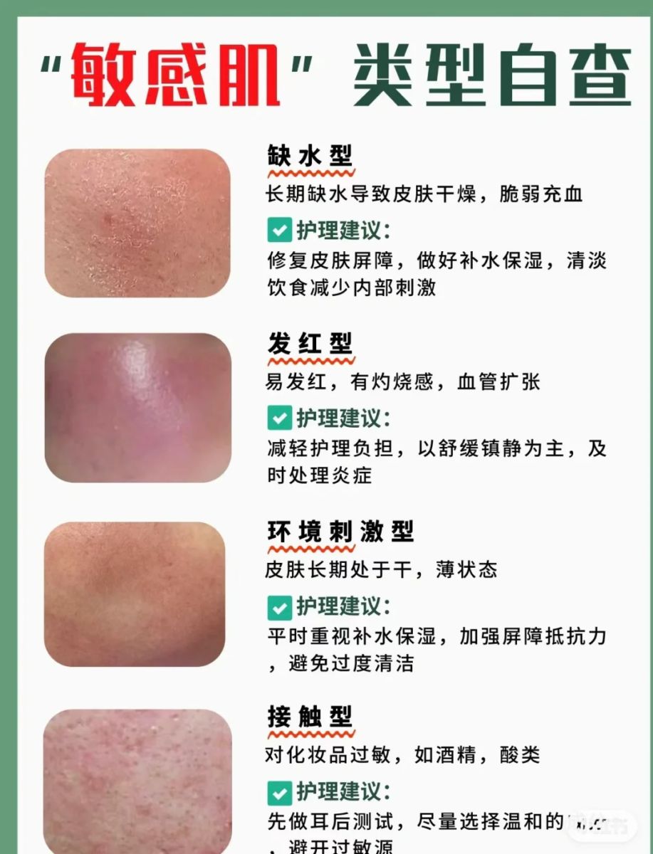 自测你属于哪一种类型的敏感肌