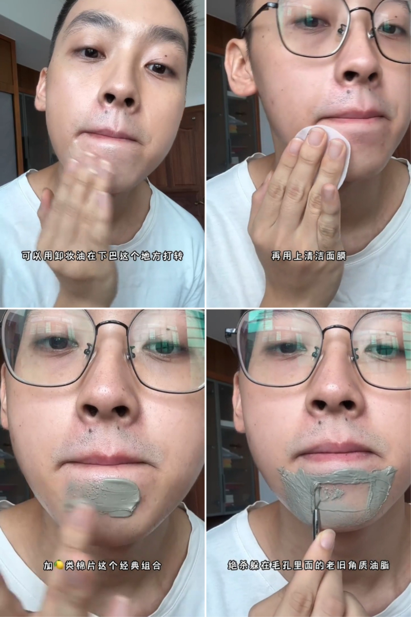 「下巴小颗粒」处理方法