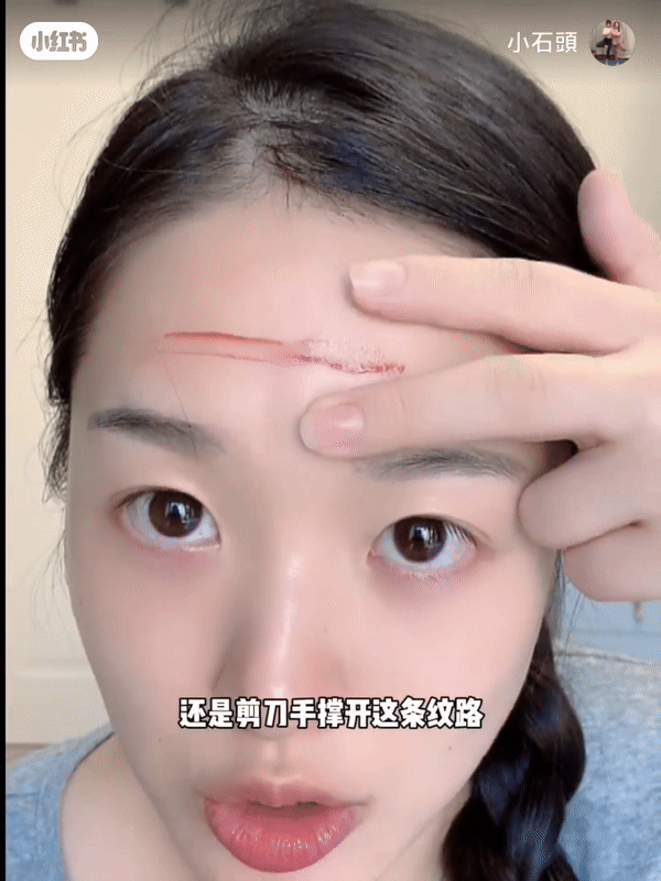 第一步：抚平横纹