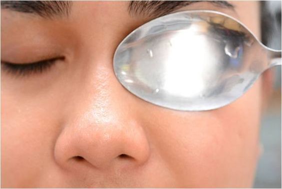 黑眼圈急救法五、勺子冷敷