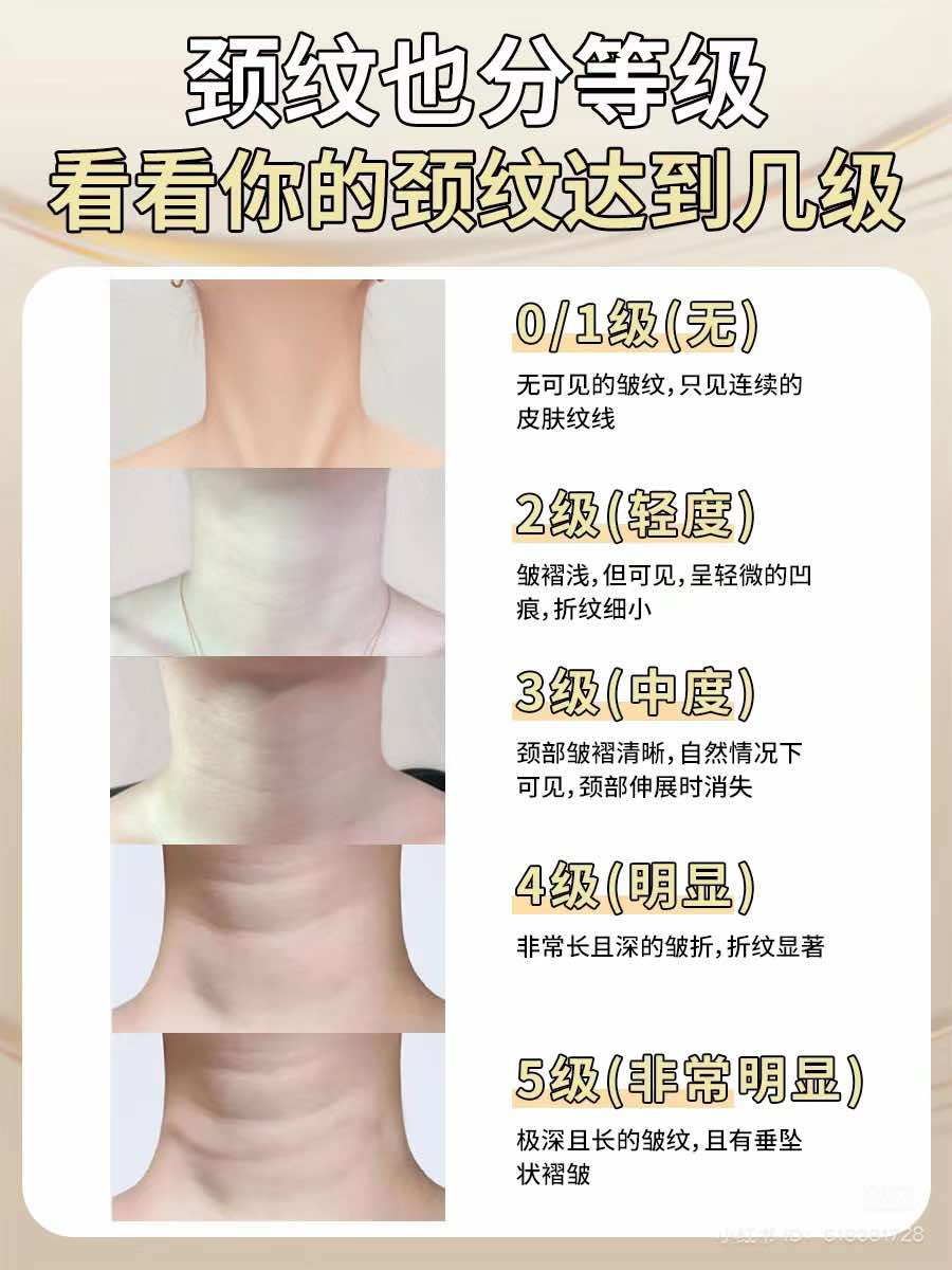 教你辨别颈纹的严重性