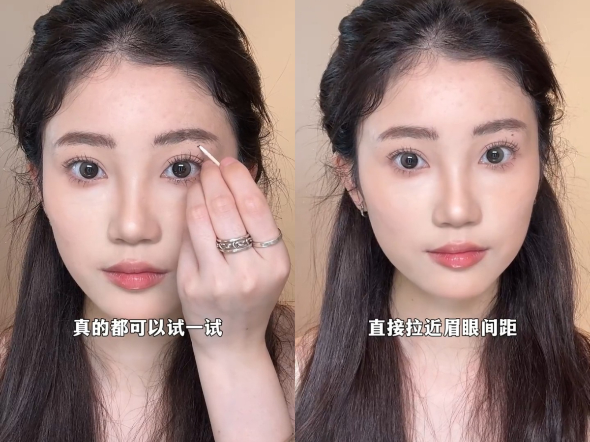 5、眉间痣