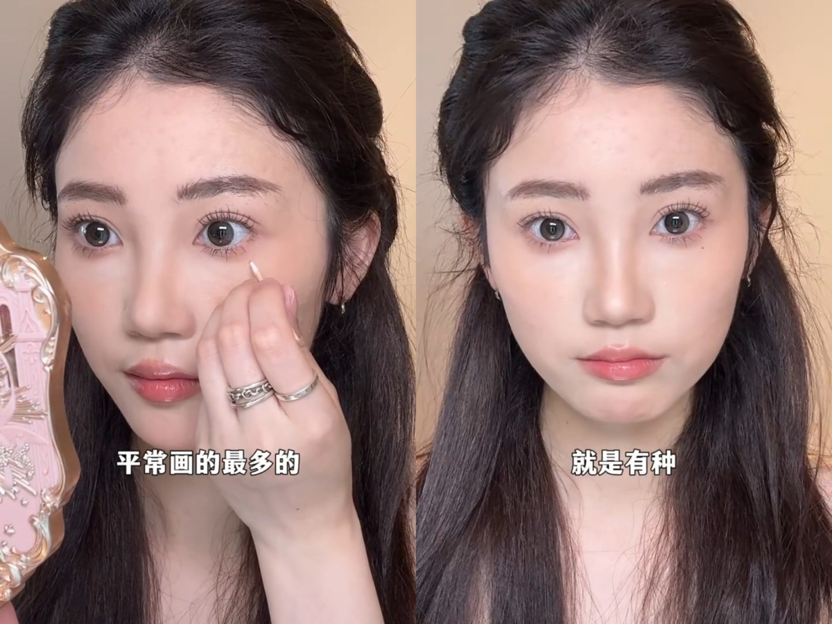 1、眼下泪痣