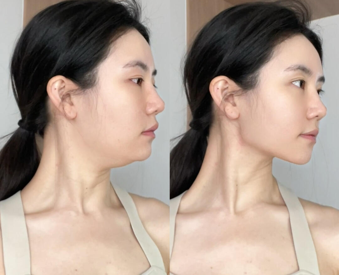 为什么脖子会变粗？