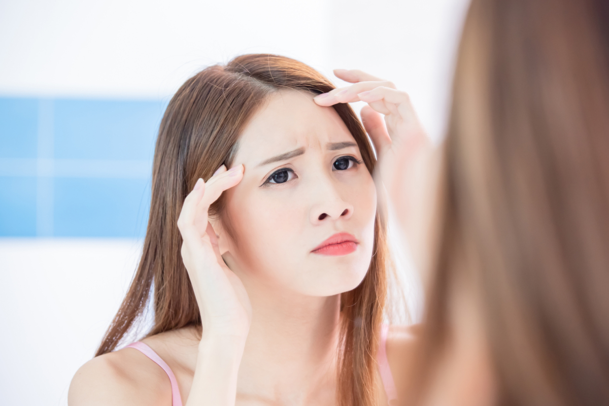 抬头纹主要分成静态纹和动态纹，各自形成的原因不同。