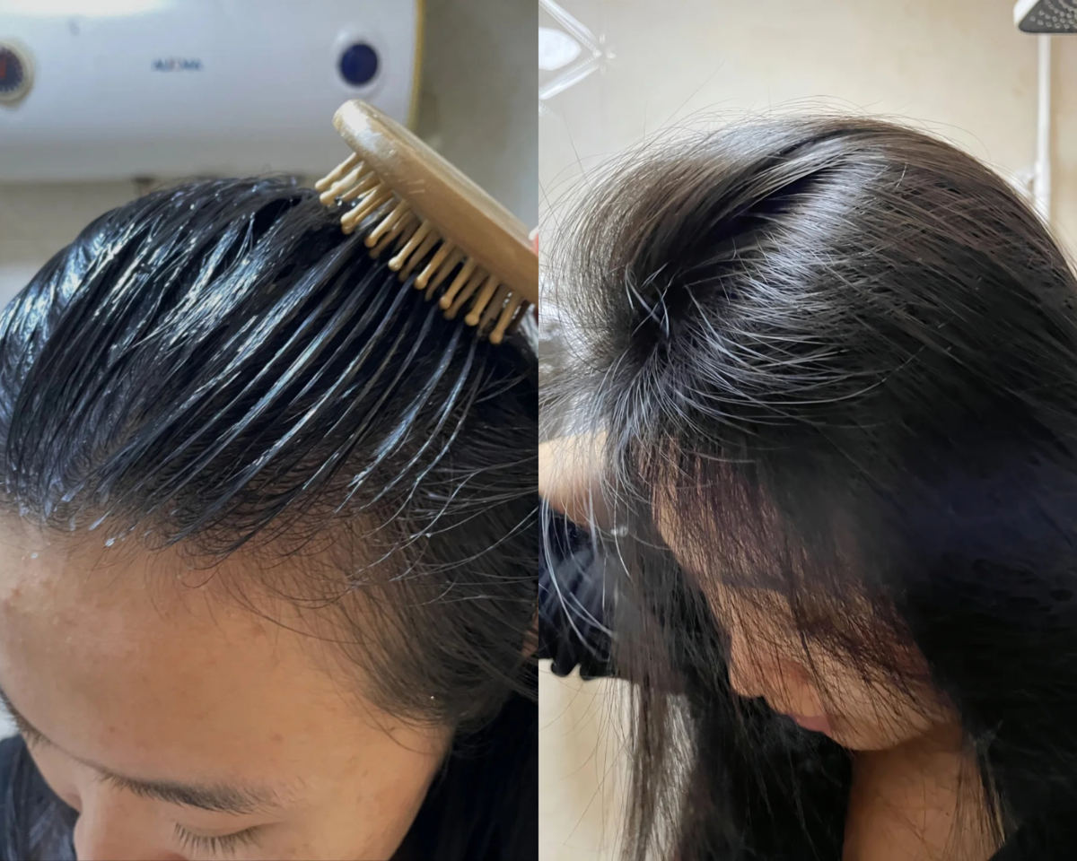 芦荟胶隐藏用法：3、去头皮屑