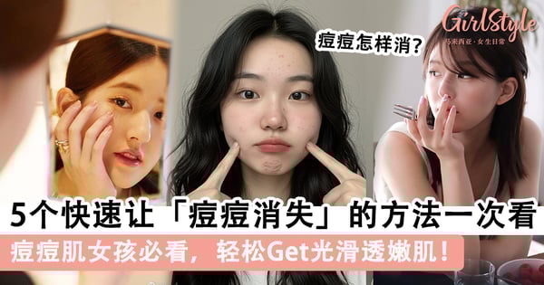 痘痘怎样消？5个快速让「痘痘消失」的方法一次看，轻松Get光滑透嫩肌！