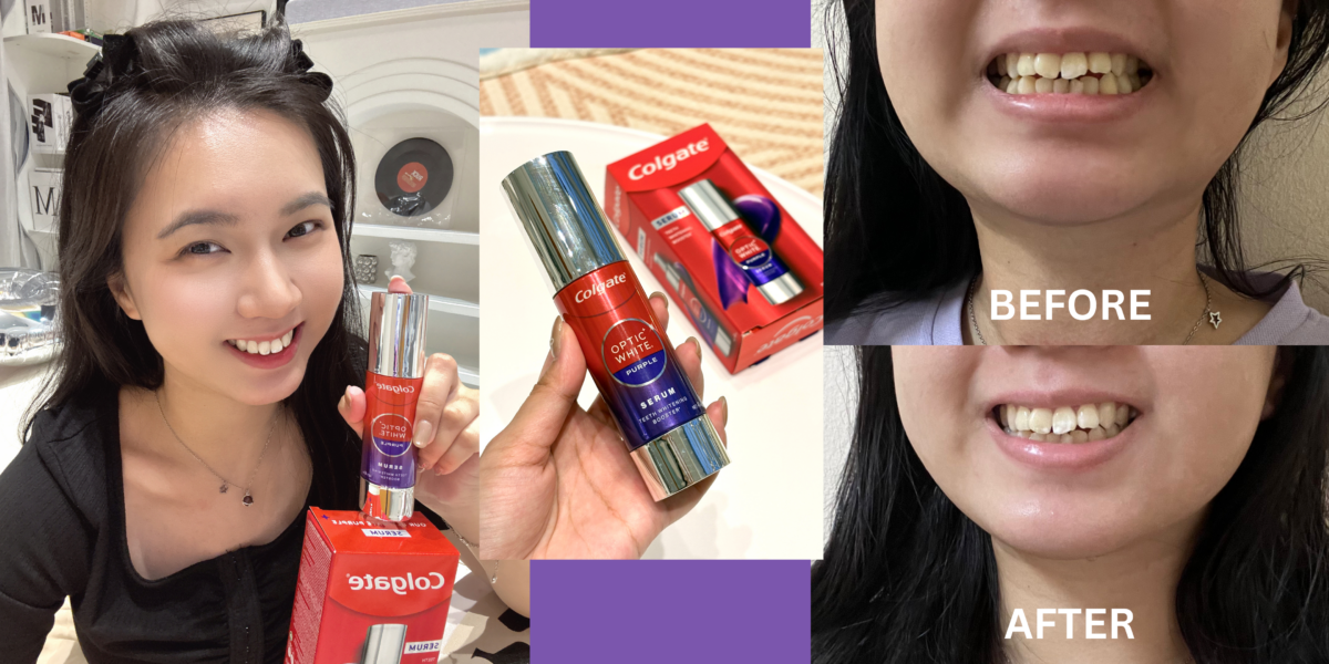 Lee Yee Mei 💜适合牙齿偏黄但又怕伤害牙釉质的人