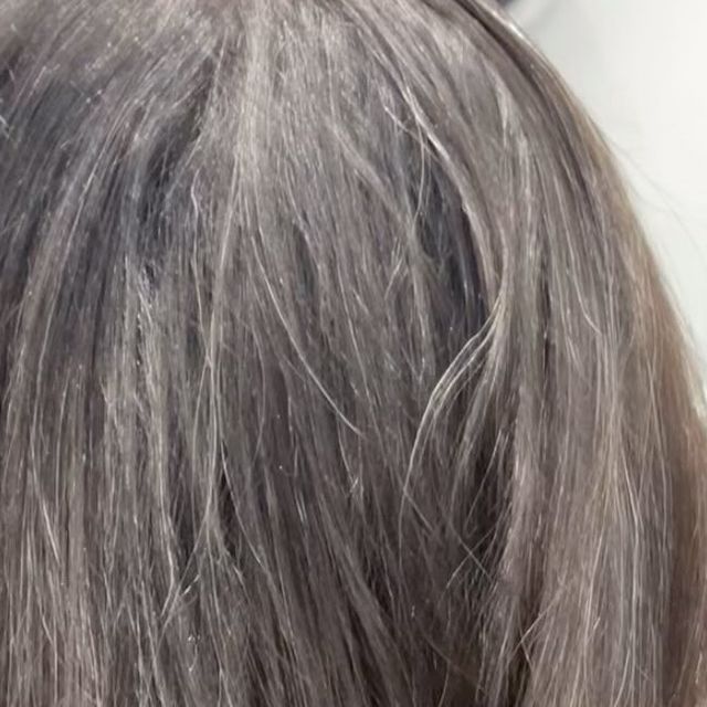 4. 后脑白发:【肾气亏虚】肾气有点虚!