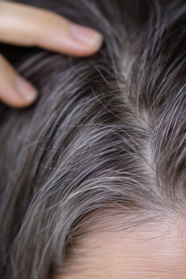 2. 前额白发:【脾胃虚弱】脾胃闹情绪了!