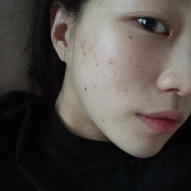 让你的脸迅速回血、恢复原状!