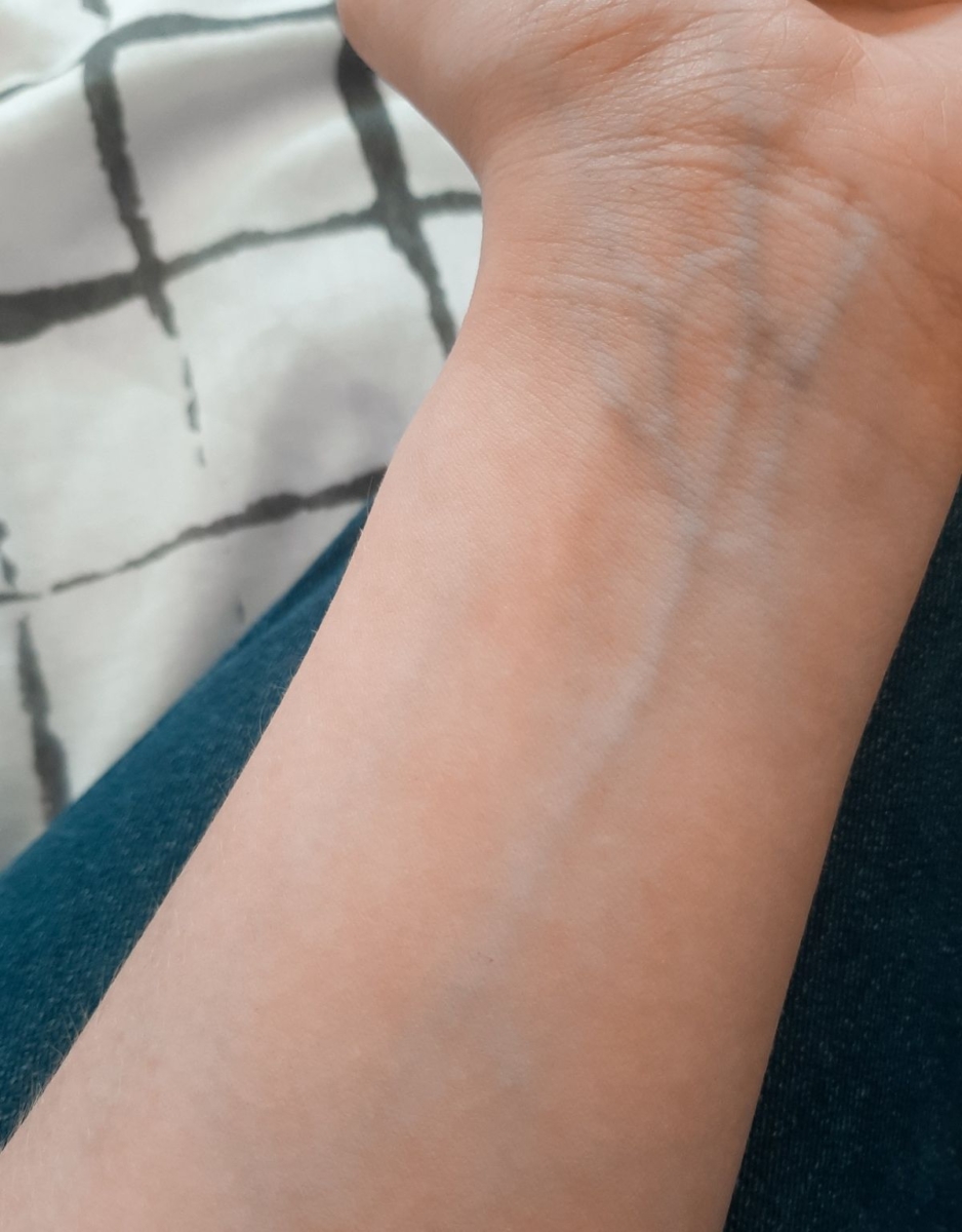 C. 静脉偏蓝、紫色