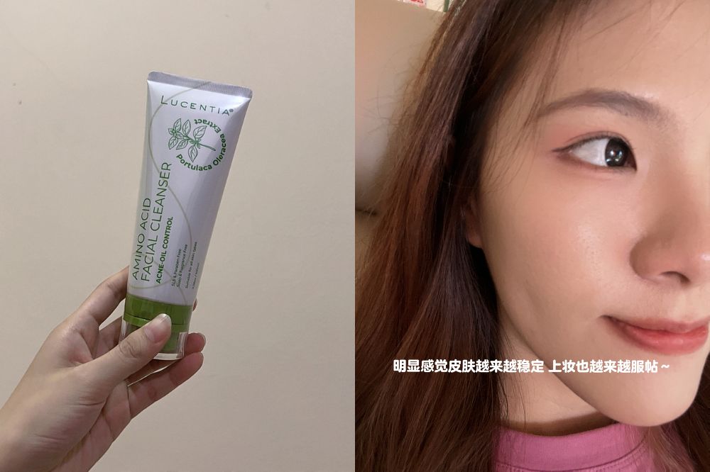 属于敏感加油性肌肤的读者 Tie Siew Li，对于Lucentia 氨基酸洁面乳“温和不刺激”这一点非常赞许！脸部时常泛红的她形容，洗完后皮肤不紧绷、不干涩，同时还起到舒缓功效，皮肤摸起来是柔软、有弹性的，终于可以跟红红的脸蛋说再见了！