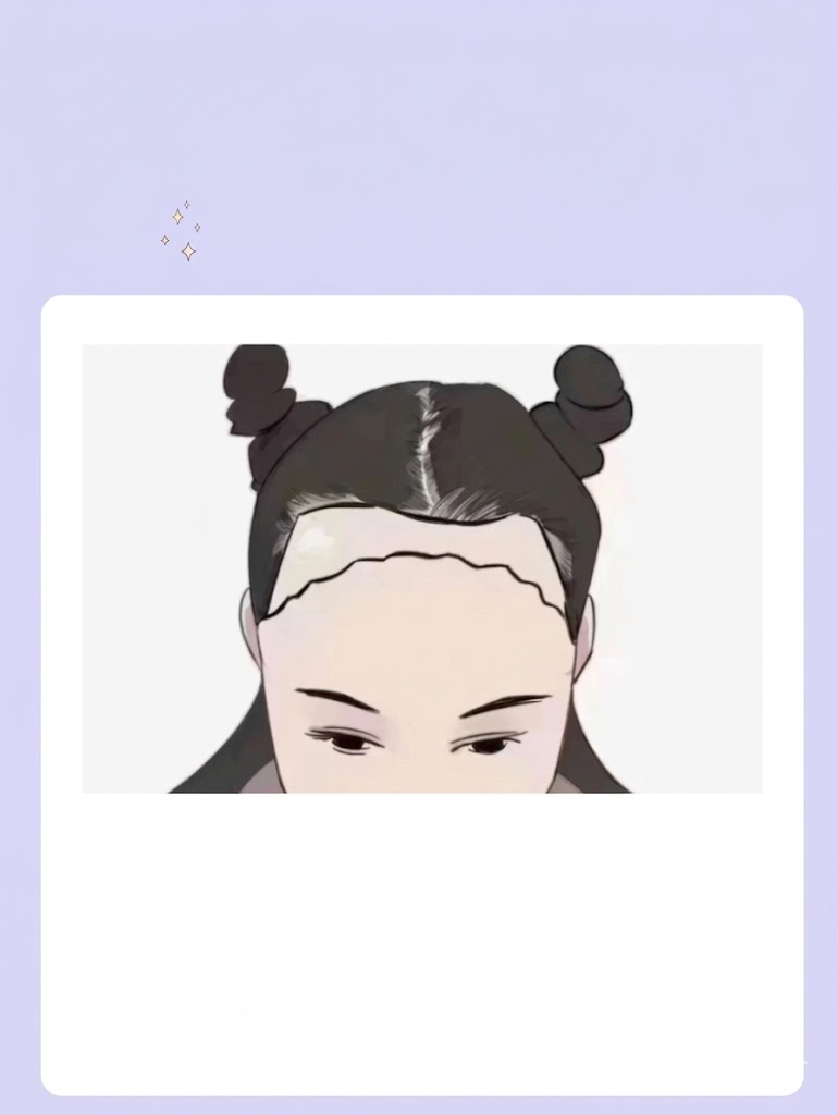 🎯 选 A 的你 👉 【1. 发际线高：脾胃与压力的警告】