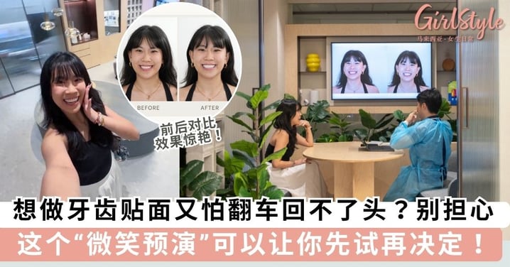想做牙齿贴面又怕翻车回不了头？别担心！这个“微笑预演”可以让你先试再决定！