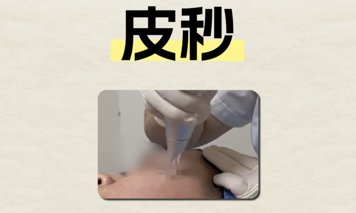 二、皮秒：斑点与黑色素的“终结者”