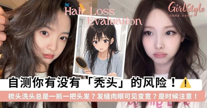 拒绝变「秃头小宝贝」！8题测出你的「秃头风险指数」，发缝变宽、掉发变细原来都是警报？