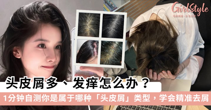头皮屑多、发痒怎么办?1分钟自测4大头皮屑类型:精准告别“雪花头”!