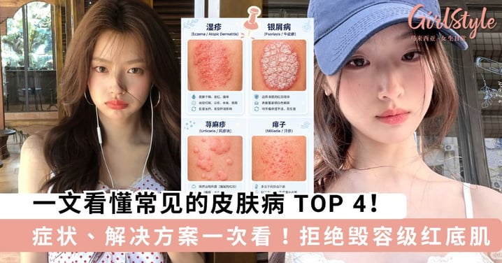 别再当成普通敏感肌!图解4大常见皮肤病,拒绝毁容级“红底肌”!
